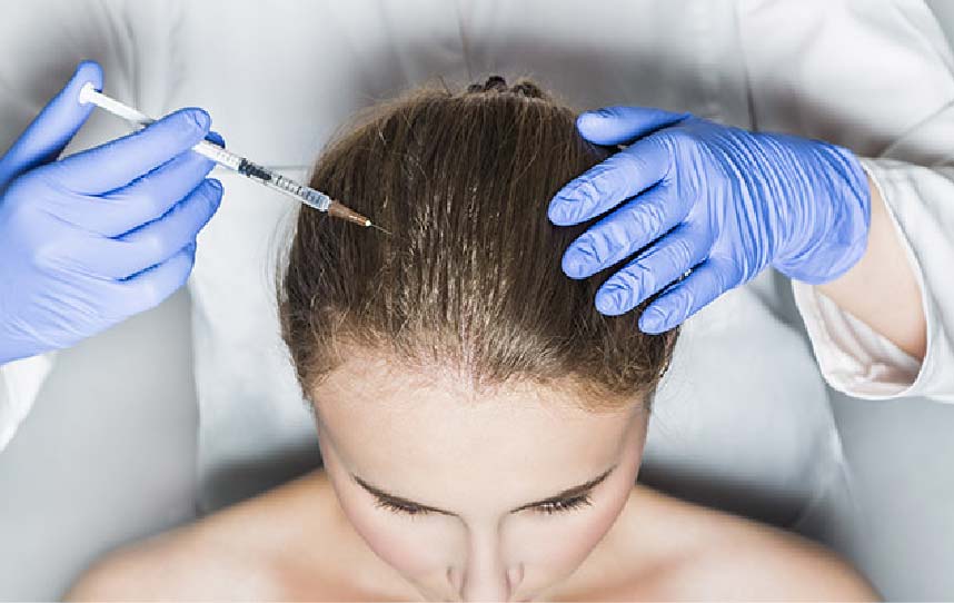 prp hair restoration